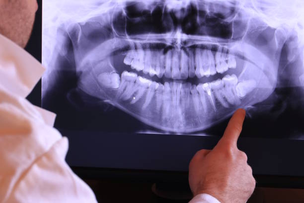 Best Emergency Dental Surgery in Guernsey, WY